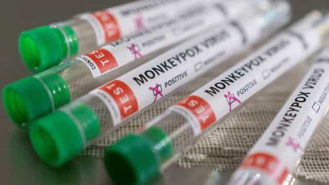 Exame descarta caso de varíola dos macacos em Macaé, no Rio de Janeiro