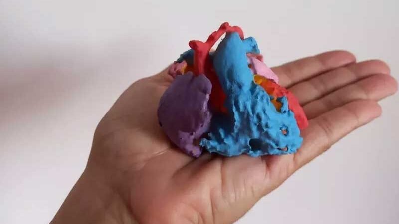 Médicos salvam a vida de bebê com coração impresso em 3D