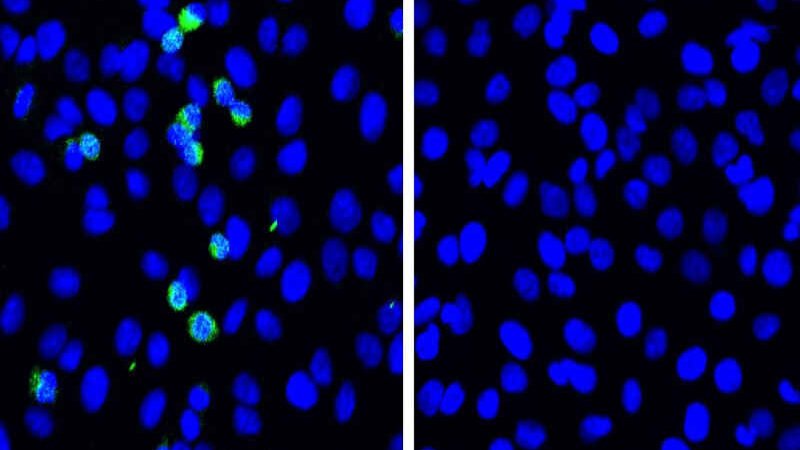 Japoneses identificam proteína que impede replicação da Covid