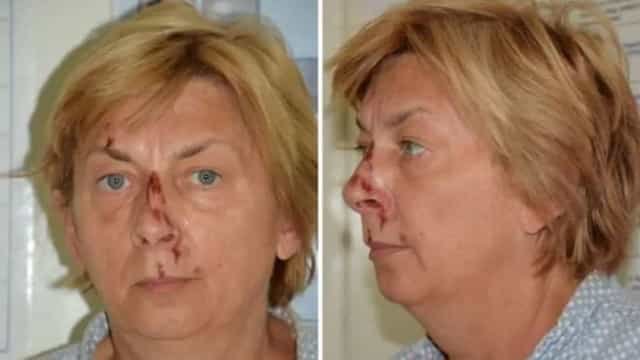 Mulher totalmente sem memória e machucada é encontrada na Croácia