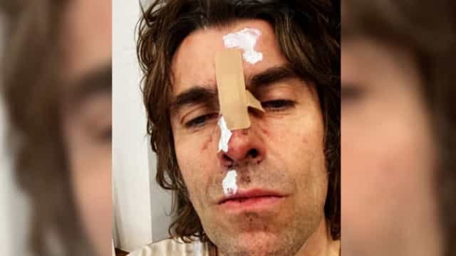 Liam Gallagher diz ter caído de helicóptero após show