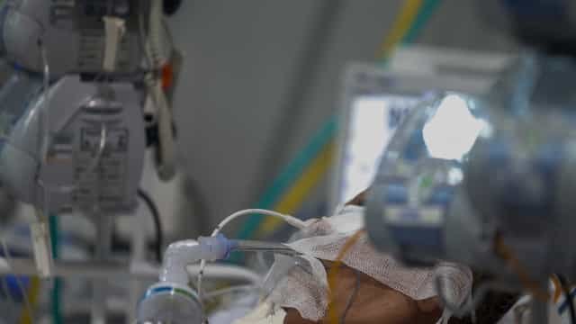 Novas internações em UTI por Covid caem em SP