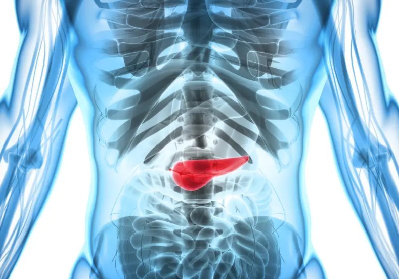 Câncer de pâncreas: cientistas brasileiros descobrem como frear a doença