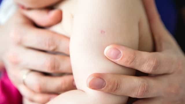 Falta de BCG faz municípios agendar e até racionar vacinas para bebês