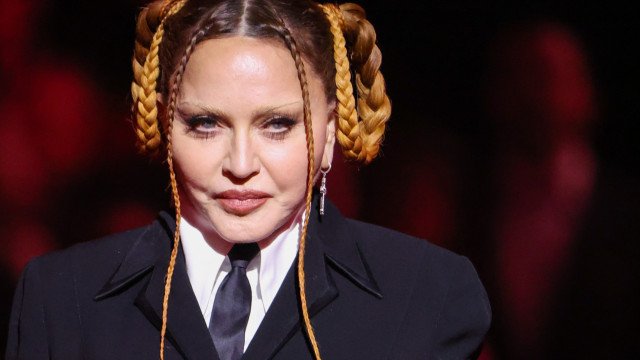 ‘Olha como estou fofa agora’, ironiza Madonna ao mostrar rosto menos inchado