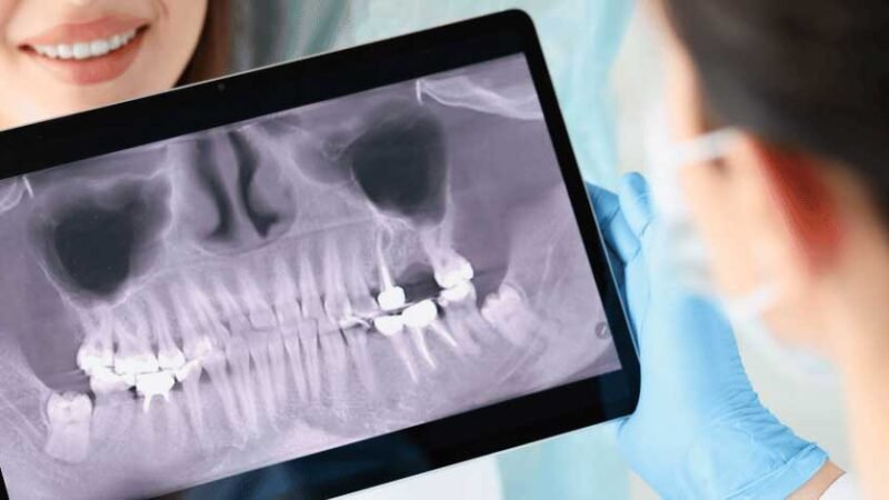 Guarantã do Norte vai otimizar tratamentos odontológicos com exames de imagem