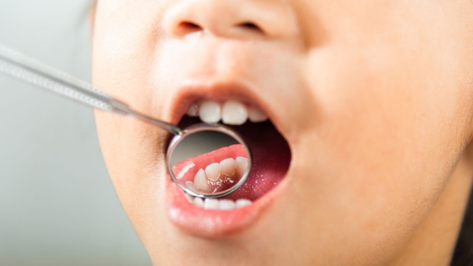 Saúde bucal infantil: 5 dicas para começar os cuidados desde cedo